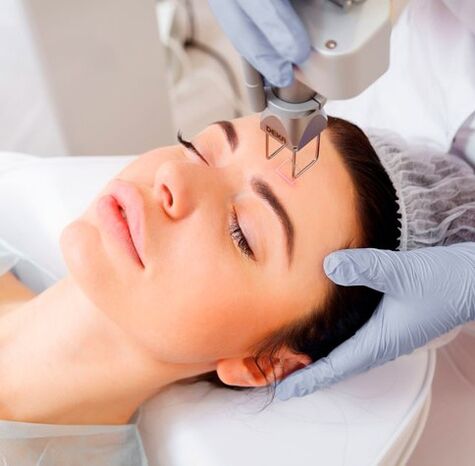 Un rejuvenecimiento con láser facial