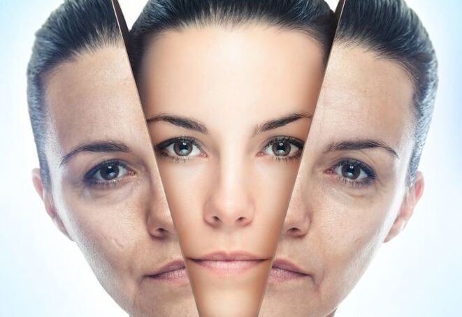 El proceso de eliminación de la piel del rostro de los cambios relacionados con la edad. 